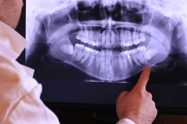 Best Emergency Care for Gum Disease in Woodside, CA
