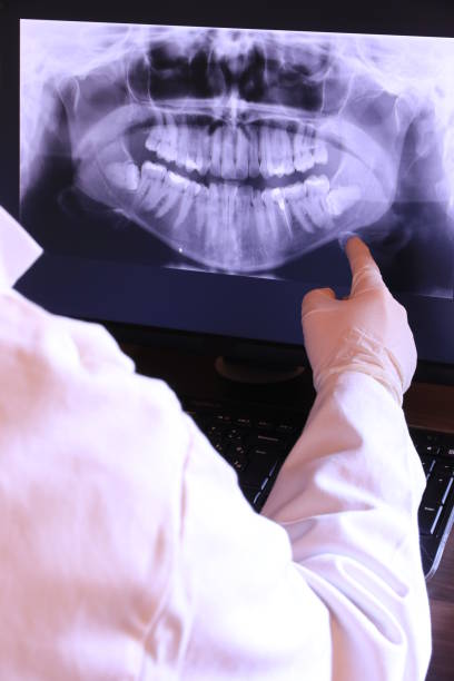 Best Emergency Denture Repair in Woodside, CA